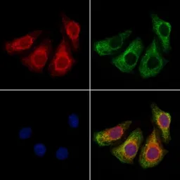 Anti-MMP9 antibody used in Immunocytochemistry/ Immunofluorescence (ICC/IF). GTX04573