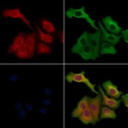 Anti-MMP9 antibody used in Immunocytochemistry/ Immunofluorescence (ICC/IF). GTX04573