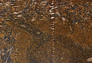Anti-MMP9 antibody used in IHC (Paraffin sections) (IHC-P). GTX04573