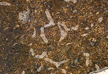 Anti-MMP9 antibody used in IHC (Paraffin sections) (IHC-P). GTX04573