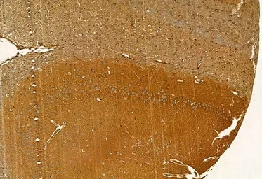 Anti-MMP9 antibody used in IHC (Paraffin sections) (IHC-P). GTX04573