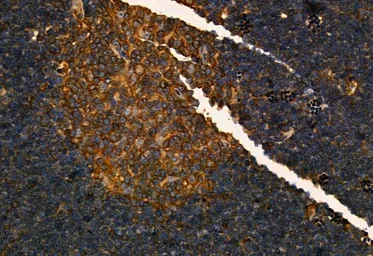 Anti-MMP9 antibody used in IHC (Paraffin sections) (IHC-P). GTX04573