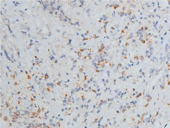 Anti-MMP9 antibody used in IHC (Paraffin sections) (IHC-P). GTX04573