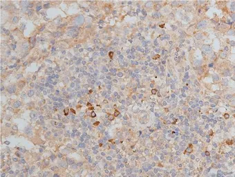 Anti-MMP9 antibody used in IHC (Paraffin sections) (IHC-P). GTX04573