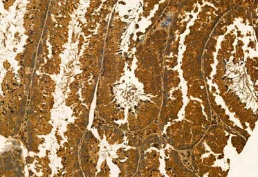 Anti-MMP9 antibody used in IHC (Paraffin sections) (IHC-P). GTX04573