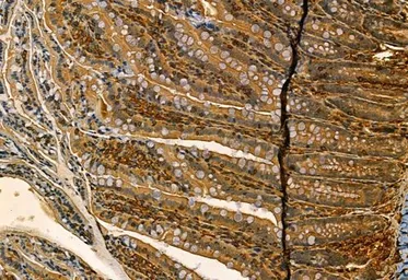 Anti-MMP9 antibody used in IHC (Paraffin sections) (IHC-P). GTX04573