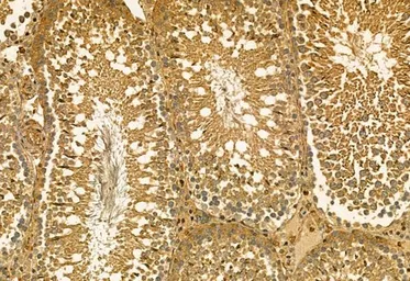 Anti-MMP9 antibody used in IHC (Paraffin sections) (IHC-P). GTX04573