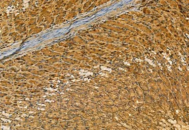 Anti-MMP9 antibody used in IHC (Paraffin sections) (IHC-P). GTX04573
