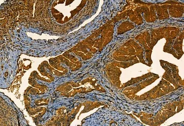 Anti-MMP9 antibody used in IHC (Paraffin sections) (IHC-P). GTX04573