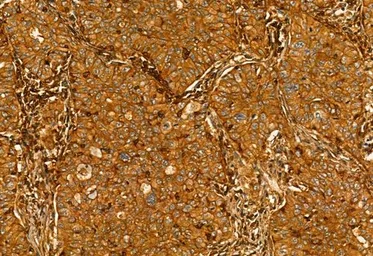 Anti-MMP9 antibody used in IHC (Paraffin sections) (IHC-P). GTX04573