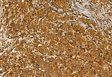 Anti-MMP9 antibody used in IHC (Paraffin sections) (IHC-P). GTX04573