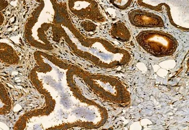 Anti-MMP9 antibody used in IHC (Paraffin sections) (IHC-P). GTX04573