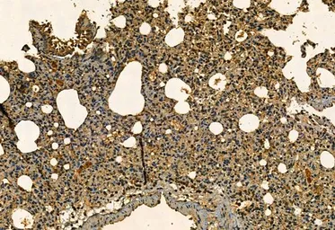 Anti-MMP9 antibody used in IHC (Paraffin sections) (IHC-P). GTX04573