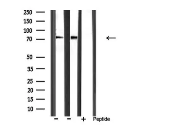 Anti-MMP9 antibody used in Western Blot (WB). GTX04573