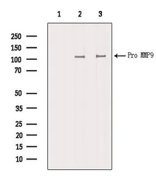 Anti-MMP9 antibody used in Western Blot (WB). GTX04573