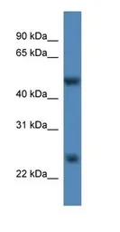 Anti-METTL4 antibody used in Western Blot (WB). GTX04574