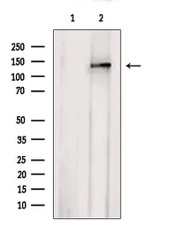Anti-AHI1 antibody used in Western Blot (WB). GTX04581