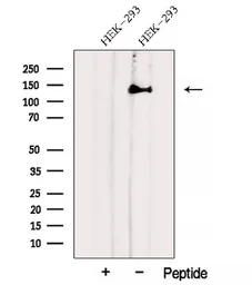 Anti-AHI1 antibody used in Western Blot (WB). GTX04581