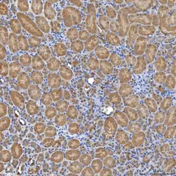 Anti-SLC20A1 antibody used in IHC (Paraffin sections) (IHC-P). GTX04583