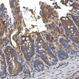 Anti-SLC20A1 antibody used in IHC (Paraffin sections) (IHC-P). GTX04583
