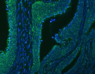 Anti-SLC20A1 antibody used in IHC (Paraffin sections) (IHC-P). GTX04583