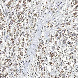 Anti-SLC20A1 antibody used in IHC (Paraffin sections) (IHC-P). GTX04583
