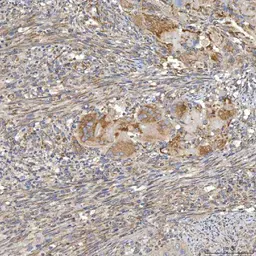 Anti-SLC20A1 antibody used in IHC (Paraffin sections) (IHC-P). GTX04583