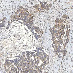 Anti-SLC20A1 antibody used in IHC (Paraffin sections) (IHC-P). GTX04583