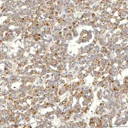 Anti-SLC20A1 antibody used in IHC (Paraffin sections) (IHC-P). GTX04583