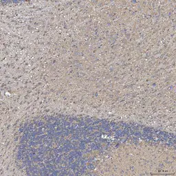 Anti-SLC20A1 antibody used in IHC (Paraffin sections) (IHC-P). GTX04583