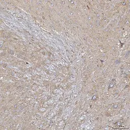 Anti-SLC20A1 antibody used in IHC (Paraffin sections) (IHC-P). GTX04583