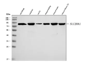 Anti-SLC20A1 antibody used in Western Blot (WB). GTX04583