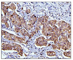 Anti-CDC42 antibody used in IHC (Paraffin sections) (IHC-P). GTX04584