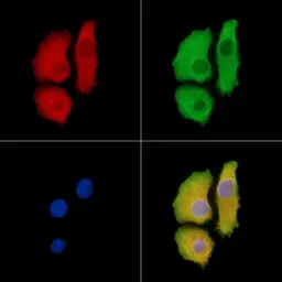 Anti-ASAP1 antibody used in Immunocytochemistry/ Immunofluorescence (ICC/IF). GTX04589
