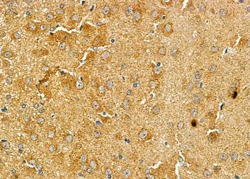 Anti-ASAP1 antibody used in IHC (Paraffin sections) (IHC-P). GTX04589