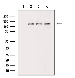 Anti-ASAP1 antibody used in Western Blot (WB). GTX04589
