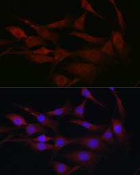 Anti-MLKL antibody used in Immunocytochemistry/ Immunofluorescence (ICC/IF). GTX04591