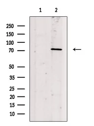 Anti-PKC beta 1 (phospho Ser661) antibody used in Western Blot (WB). GTX04593