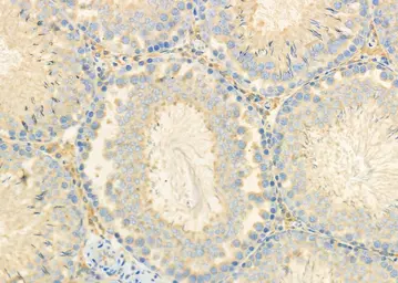 Anti-CEACAM6 antibody used in IHC (Paraffin sections) (IHC-P). GTX04599