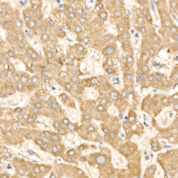 Anti-YKL-39 antibody used in IHC (Paraffin sections) (IHC-P). GTX04607