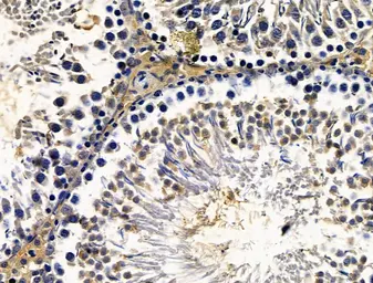 Anti-GIP antibody used in IHC (Paraffin sections) (IHC-P). GTX04612