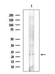 Anti-GIP antibody used in Western Blot (WB). GTX04612