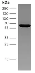 Canine parvovirus type 2b VP2 protein. GTX04616-pro