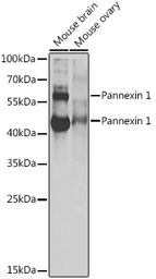 Anti-Pannexin 1 antibody used in Western Blot (WB). GTX04618