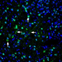 Anti-Pannexin 1 antibody used in IHC (Free Floating) (IHC (Free Floating)). GTX04619