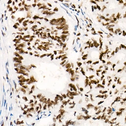 Anti-SNF5 antibody [ARC53139] used in IHC (Paraffin sections) (IHC-P). GTX04623