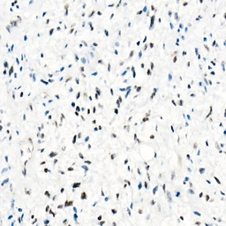 Anti-SNF5 antibody [ARC53139] used in IHC (Paraffin sections) (IHC-P). GTX04623