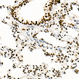 Anti-SNF5 antibody [ARC53139] used in IHC (Paraffin sections) (IHC-P). GTX04623