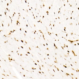 Anti-SNF5 antibody [ARC53139] used in IHC (Paraffin sections) (IHC-P). GTX04623