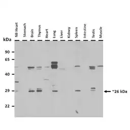 Anti-CHMP4C antibody used in Western Blot (WB). GTX04627
